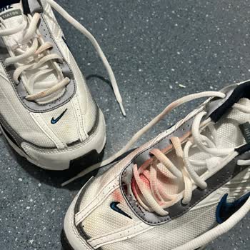 Nike Initiator Ayakkabısının Kaymaz Olmaması Nedeniyle Ciddi El Yaralanması