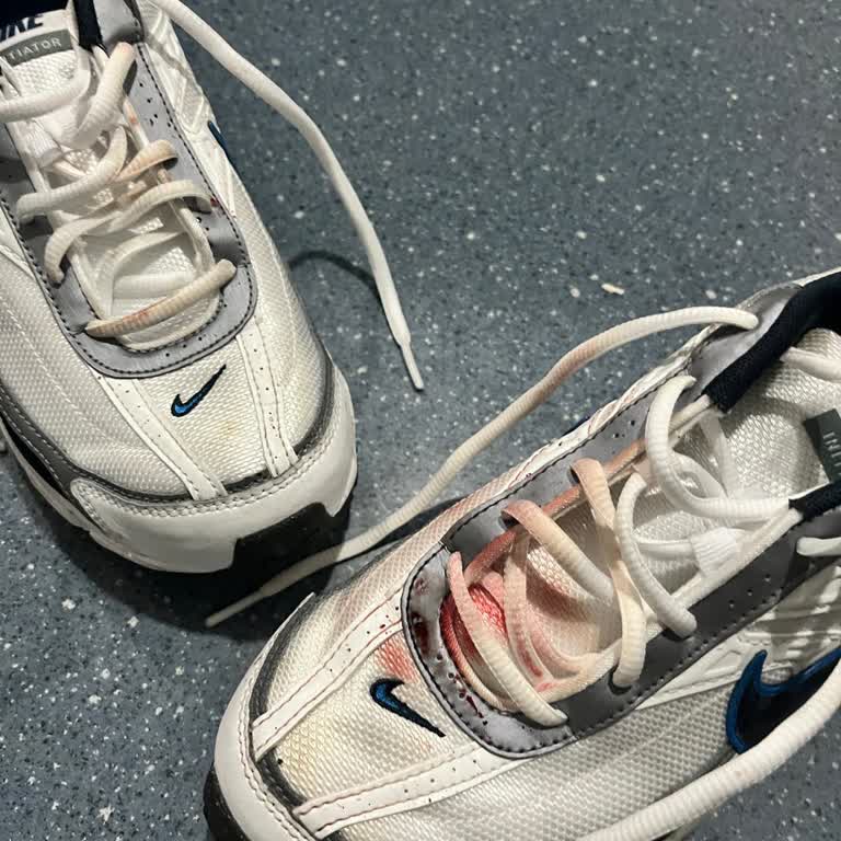 Nike Initiator Ayakkabısının Kaymaz Olmaması Nedeniyle Ciddi El Yaralanması