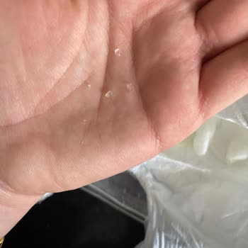 Molfix 3 Numaralı Bezinde Emici Partiküller Kaçıyor Ve Cilde Yapışıyor