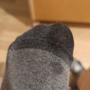 Su Geçirmez Özelliği Bozulmuş Skechers Ayakkabısının Su Alması Ve İade Reddi