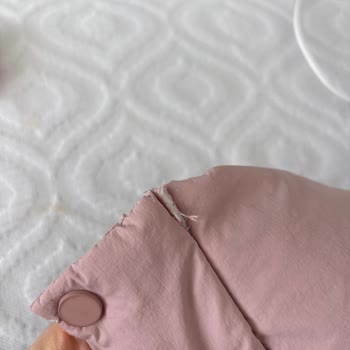 Zara Montunda Yoğun Tüy Bırakma Ve Dikiş Sorunu