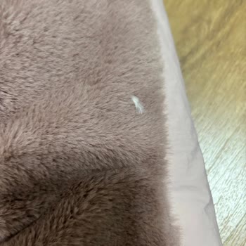 Zara Montunda Yoğun Tüy Bırakma Ve Dikiş Sorunu