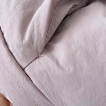 Zara Montunda Yoğun Tüy Bırakma Ve Dikiş Sorunu