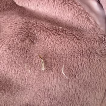 Zara Montunda Yoğun Tüy Bırakma Ve Dikiş Sorunu