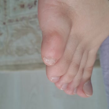 Bot Yaralıyor Ve İade Talebine Cevap Almıyor