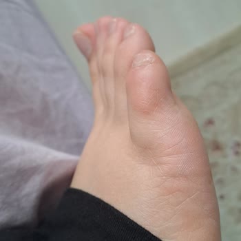 Bot Yaralıyor Ve İade Talebine Cevap Almıyor