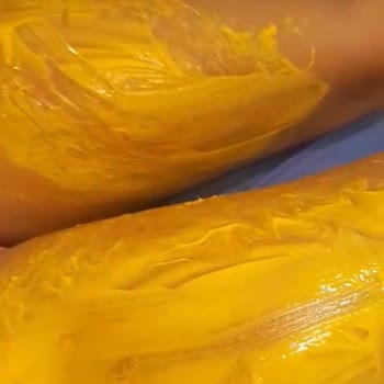 Arçelik Çay Makinesi Patladı Bacaklarım Yanık Oldu