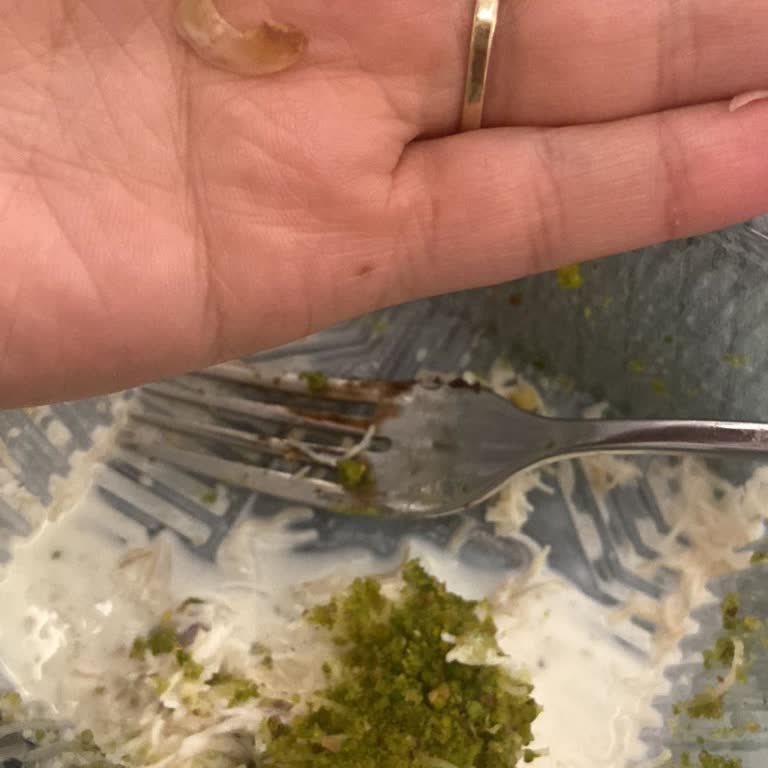 Hünerli Fırın (Kocaeli) Sütlü Kadayıftan Tırnak Parçası Çıktı, Sağlık Sorunu Ve Yanıtsız Şikayet