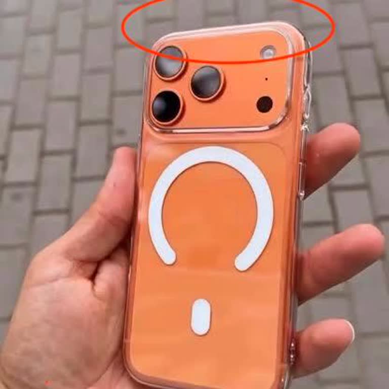 Kalitesiz Kılıf Ve Lens Koruyucu Telefonumu Çizdi