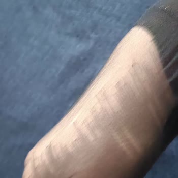 Çoraplar Tel Tel Dökülüyor Acil Değişim Gerekiyor