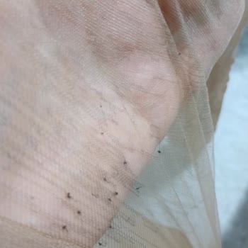 Çoraplar Tel Tel Dökülüyor Acil Değişim Gerekiyor