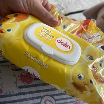 Dalin Bebek Cildinde Şiddetli Tahriş Yaratılan Islak Mendil