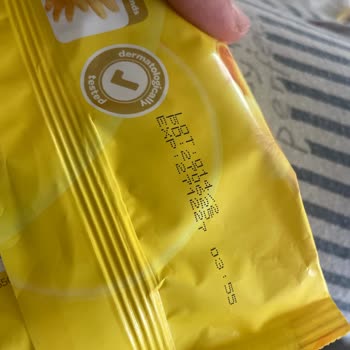 Dalin Bebek Cildinde Şiddetli Tahriş Yaratılan Islak Mendil