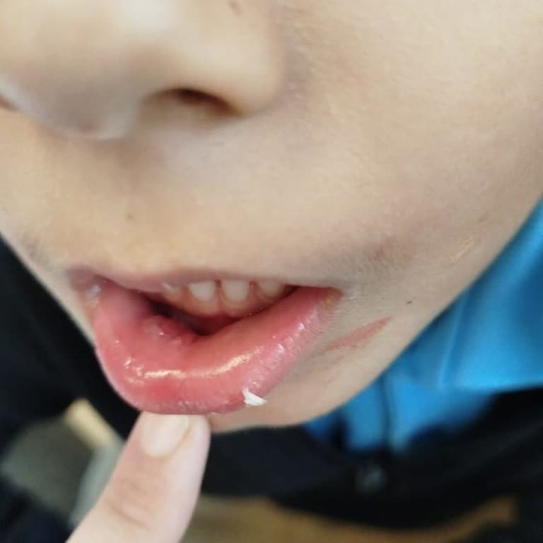 Gülensu İlkokulu Çocuğumun Fiziksel Şiddete Maruz Kalması Ve Denetim İhmalinin Durdurulması!