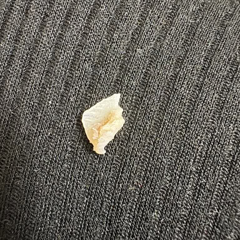 Burger King Double King Chicken Menüde Kemik Parçası Ve Sağlık Riski