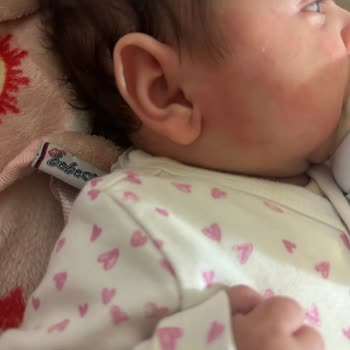 Bebek Cildinde Yanma Ve Kötüleşme Nedeniyle La Roche-Posay Ürününden İade Talebi