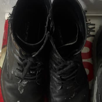 Ayıplı Lotto Spor Ayakkabı Nedeniyle Ayak Sağlığında Ağrı Ve Garanti Değişim Talebi