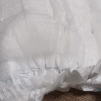 Molfix Junior Bebek Bezinde Kalkan Tabaka Çıkarak Şiddetli Pişik Oluşturuyor