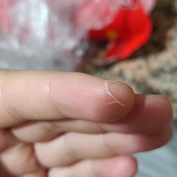 Pınar Et Ve Süt Hindi Salamdan Tüy Benzeri Cisim Çıktı!
