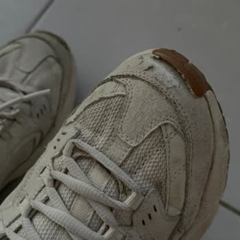 Skechers Ayakkabıda Deri Dökülmesi Ve Açılmalar, 6 Ayda Kullanıcı Hatası İddiasıyla Reddedildi