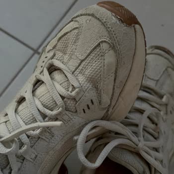 Skechers Ayakkabıda Deri Dökülmesi Ve Açılmalar, 6 Ayda Kullanıcı Hatası İddiasıyla Reddedildi