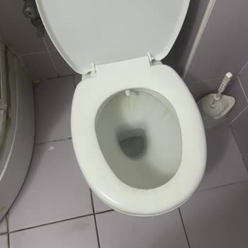 Doğum Sonrası Oda Hijyeninin Yetersizliği Ve Personel İhmali