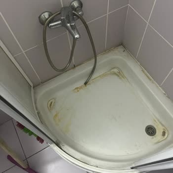 Doğum Sonrası Oda Hijyeninin Yetersizliği Ve Personel İhmali