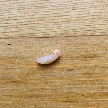 Namet Sucuğunda Bulunan Kemik Parçası Dişime Zarar Verdi