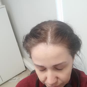 Aynı L’Loreal Saç Boyasında Renk Uyumsuzluğu Ve Üretim Sorunu