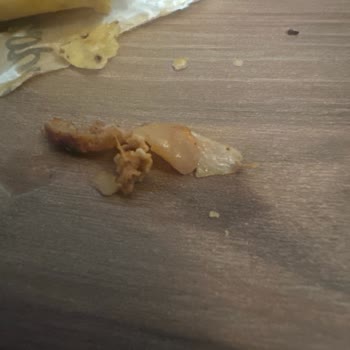 Çiğ Tavuk Döneri Nedeniyle Karın Ağrısı Ve Gıda Güvenliği Şikayeti