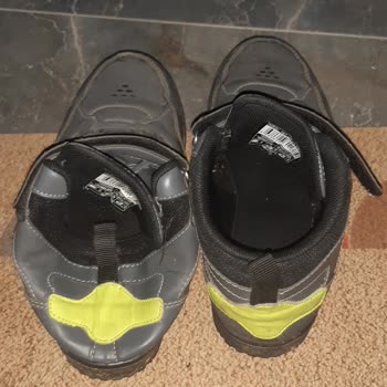 Yırtık Topuklu Çocuk Ayakkabısı Çocuğumun Ayağını Yaraladı, Mağaza Hatasız Dedi