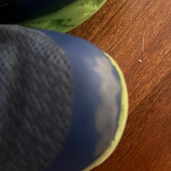 Skechers Ayakkabısında Hızlı Renk Atması Ve Boyner’in Reddetme Cevabı