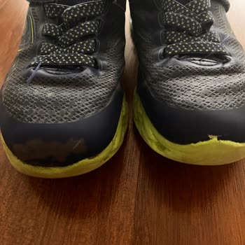 Skechers Ayakkabısında Hızlı Renk Atması Ve Boyner’in Reddetme Cevabı