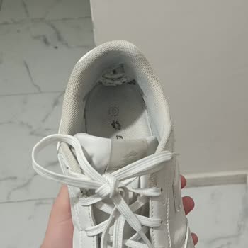 2 Yıllık Garantili Ayakkabım Kısa Sürede Deforme Oldu Ve Değişim Talebim Reddedildi