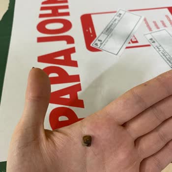 Yemeksepeti Üzerinden Sipariş Edilen Pizza İçinde Yabancı Cisim Diş Kırılmasına Neden Oldu