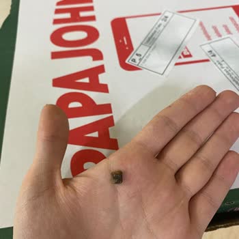 Yemeksepeti Üzerinden Sipariş Edilen Pizza İçinde Yabancı Cisim Diş Kırılmasına Neden Oldu