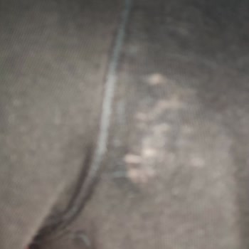 Skechers Eşofman Altı Kısa Sürede Deforme, Boyner Değişim Talebi Reddedildi