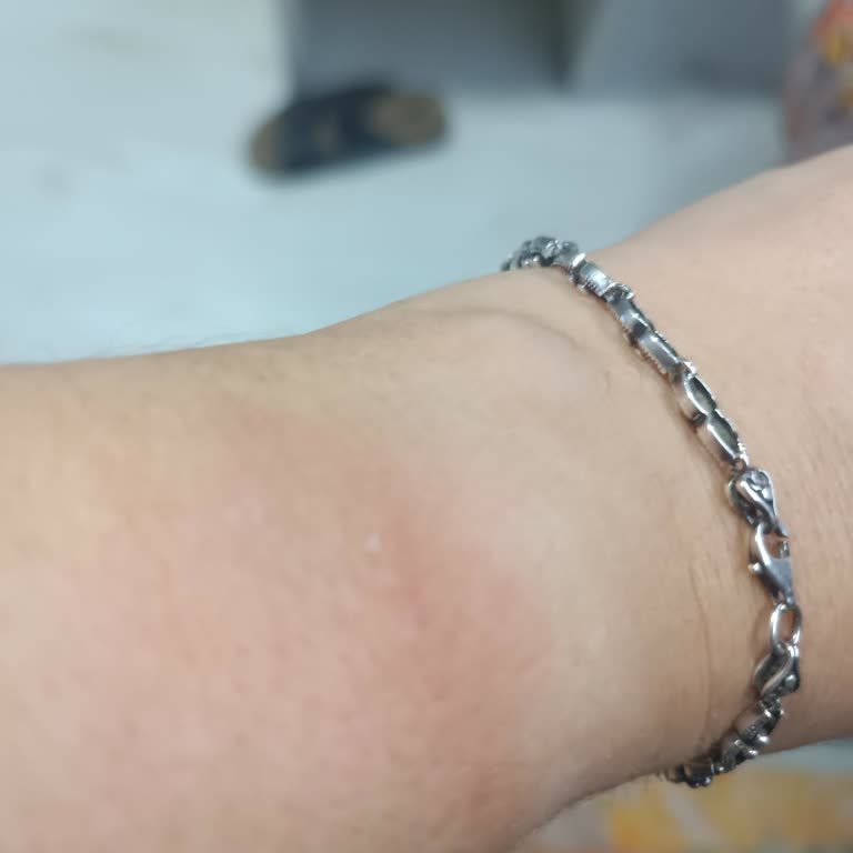 Alerjik Cilt Tahrişi Ve Servis Sorunları Nedeniyle Huawei Watch GT4 İadesi Talebi