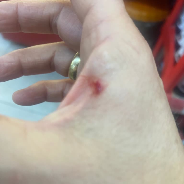 A101 Şubesinde Kediden Tırmalanma Ve Çalışanların Yardım İhmali