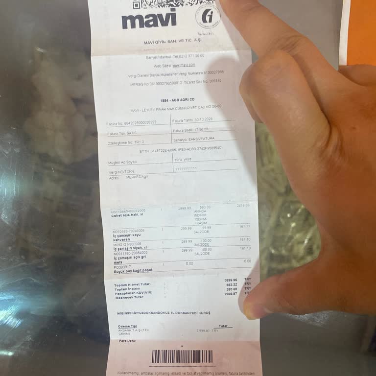 Mont Rengi Hızla Soldu, Dikişler Attı: Değişim Ve İade Talebi