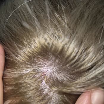 Yirmiyedi Ankara Kuaför Saçlarımda Ciddi Derecede Yıpranma, Esneme Ve Kopmalar Meydana Geldi