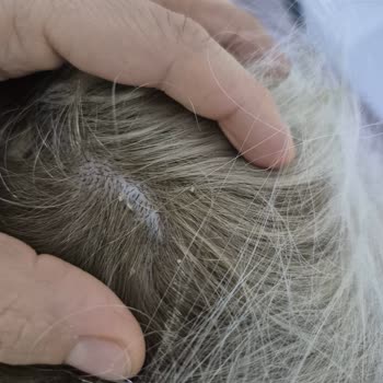 Yirmiyedi Ankara Kuaför Saçlarımda Ciddi Derecede Yıpranma, Esneme Ve Kopmalar Meydana Geldi