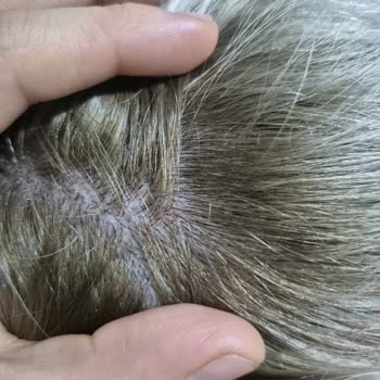 Yirmiyedi Ankara Kuaför Saçlarımda Ciddi Derecede Yıpranma, Esneme Ve Kopmalar Meydana Geldi