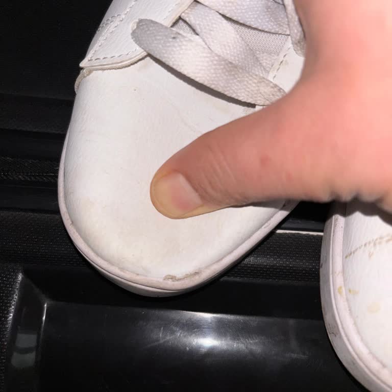 Puma Ayakkabısının Ön Kısmı Bir Ayda Çöktü, Ücret İadesi İstiyorum