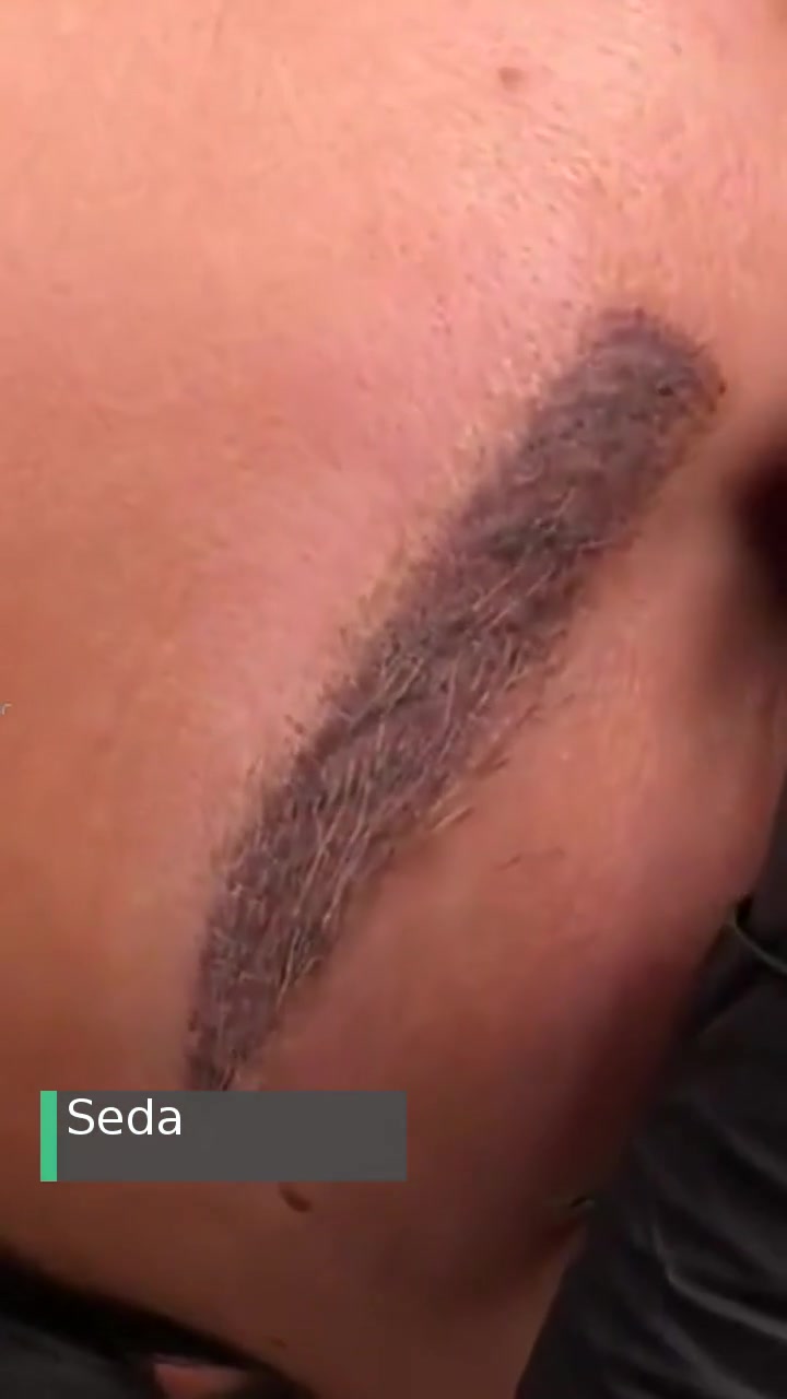 Bahar Babacan Beauty Center Kaş Hüsranı! videonun kapak resmi