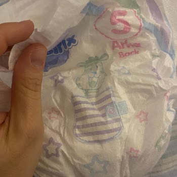 Molfix Bebek Bezinde Sert Metalik Parça Güvenlik Problemi