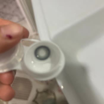 Lensamor Firmasından Aldığım Kontakt Lenste Ciddi Batma Sorunu Yaşıyorum