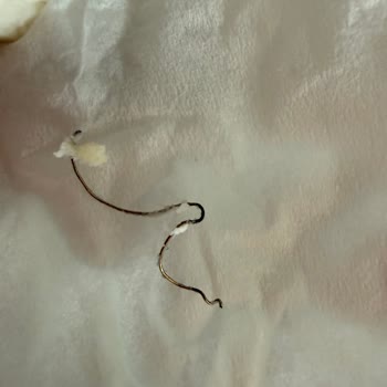 Sarıyer Market Tulum Peynirinde Tel Bulunması Ve Can Güvenliği Riski