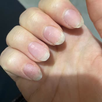 Son Dakika Personel Değişikliği Ve İlgisiz Yaklaşım Nedeniyle Tırnaklarım Kırıldı