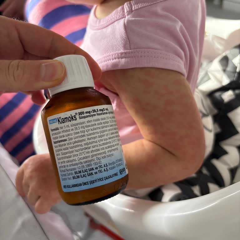 Bebeğimde Klamoks 200 Miligramlık Süspansiyon Sonrası Şiddetli Alerjik Reaksiyon Ve Tazminat Talebi